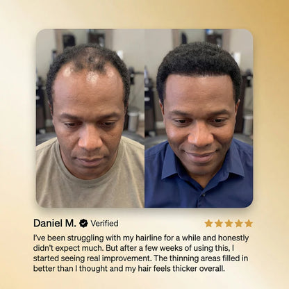The "Miracle Oil" for Stubborn Hair Loss🔮 The Ultimate Hair Regrowth Therapy -III