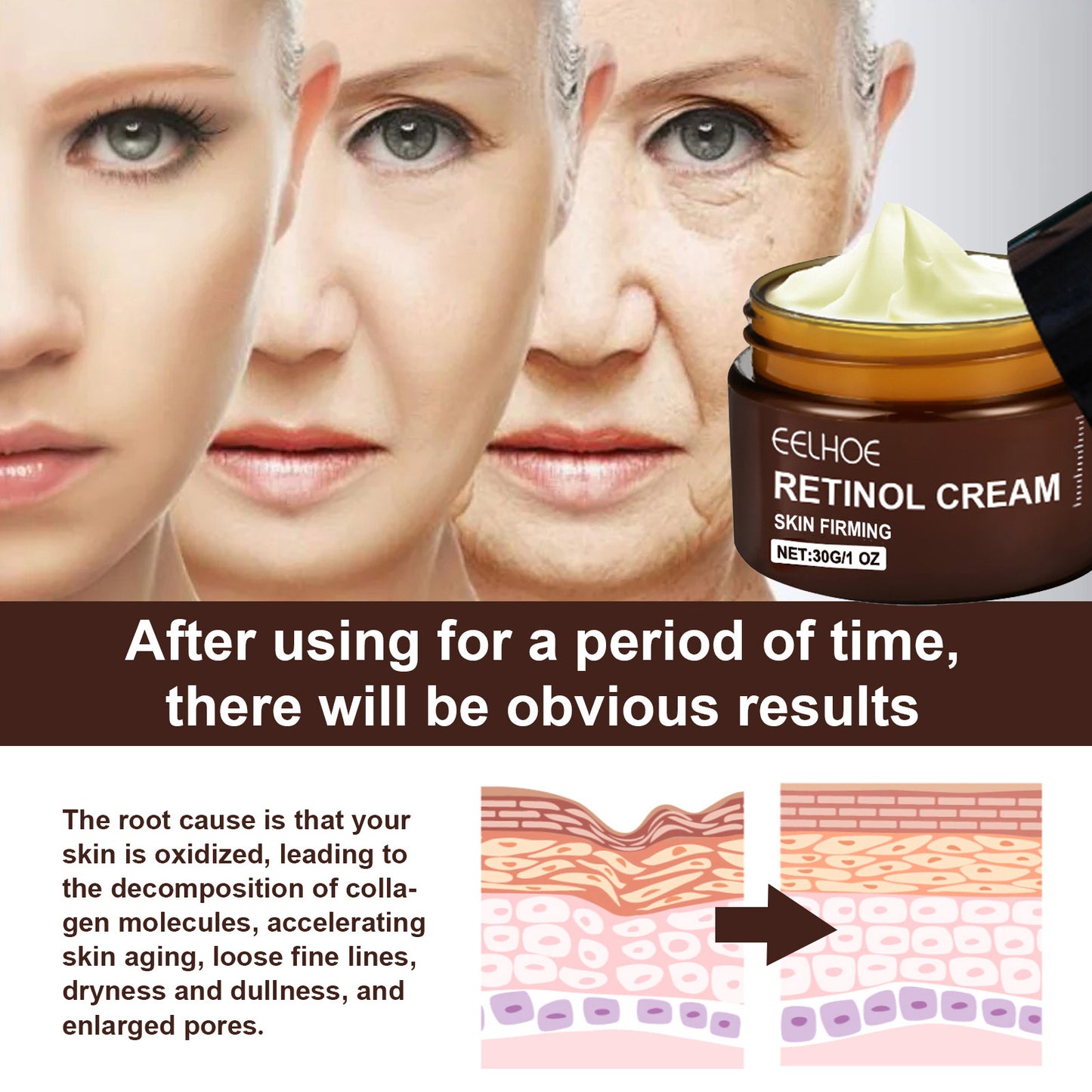 EELHOE Retinol Anti-Aging Face Cream, Skin Firming Wrinkle Reducing Moisturizer, Brightening Hydrating Facial Cream for Fine Lines & Dull Skin 30g-AUX