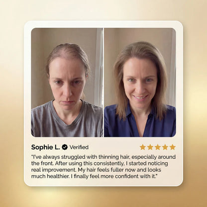 The "Miracle Oil" for Stubborn Hair Loss🔮 The Ultimate Hair Regrowth Therapy -III