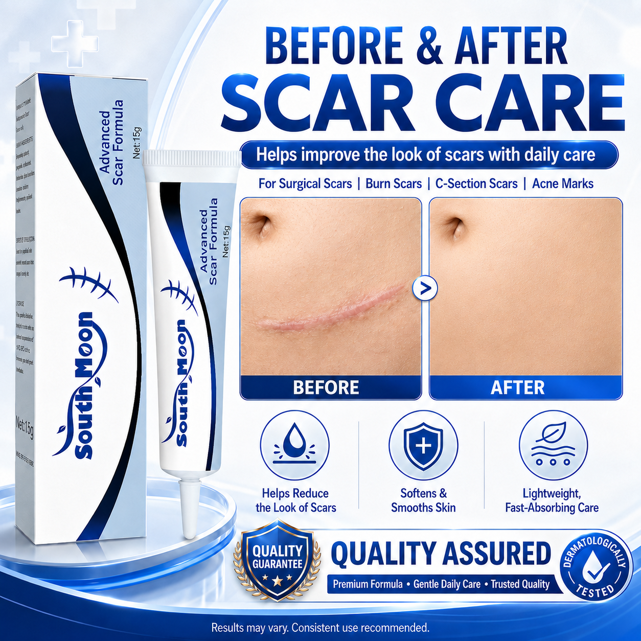 🔥Buy 3 — Long-lasting scar removal