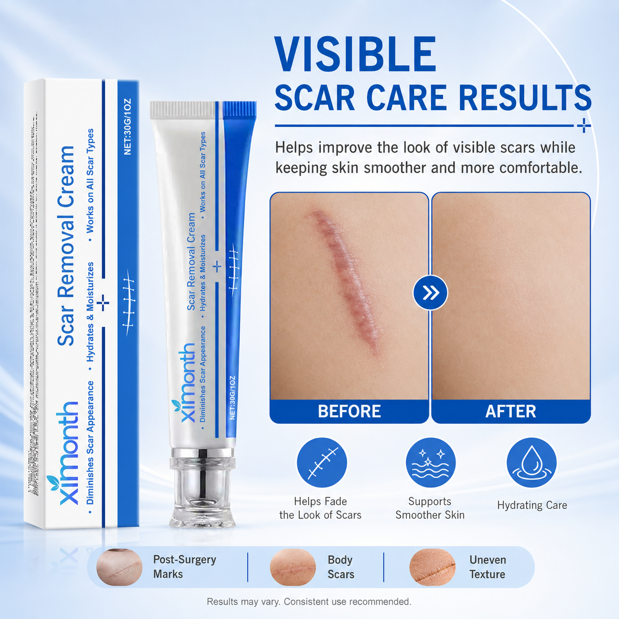 Scar Removal Cream – Smooth, Hydrate & Improve the Look of Scars-HJY