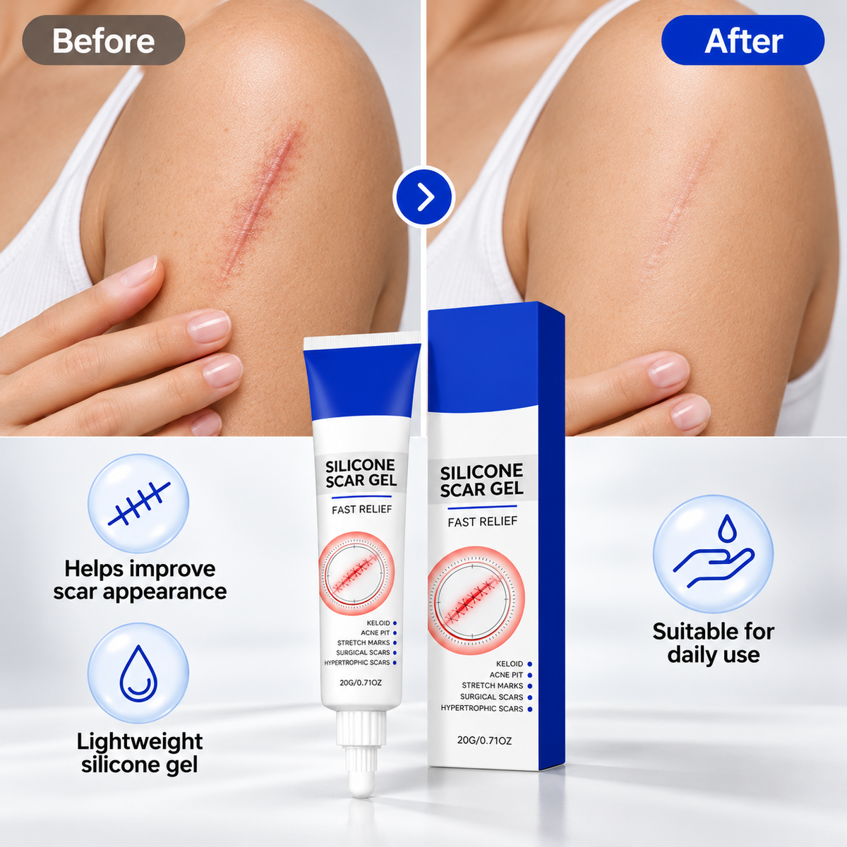 Smoother-Looking Skin Starts with Consistent Scar Care-HJY