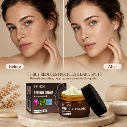 🥰EELHOE Retinol Anti-Aging Cream –✨ Bring Back Your Youthful Radiance！-AUX