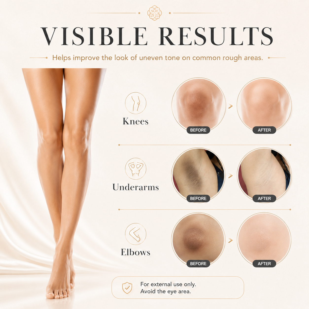 🥰Brightening Cream – Targets melanin and dark spots all over the body, evens skin tone and lightens your skin.-AUX