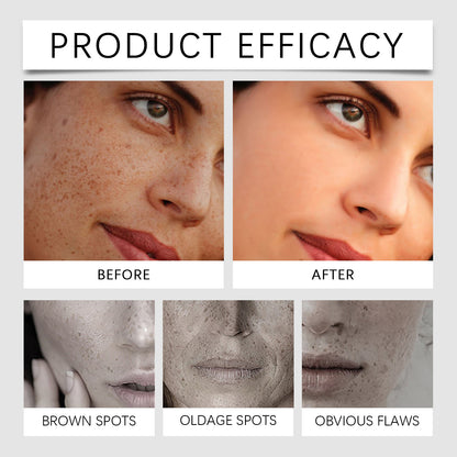 Advanced Dark Spot Repair Serum - Formulated specifically for sun spots, age spots, and melasma - XXS