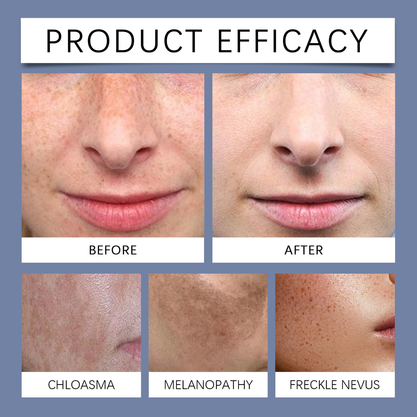 Multi-effect formula targeting sun spots, age spots, and melasma - Advanced Dark Spot Repair Serum - XXS