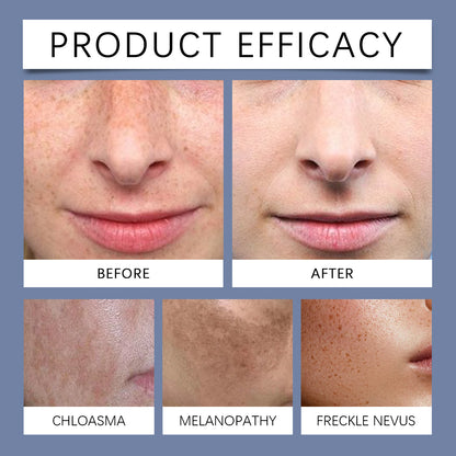 Multi-effect formula targeting sun spots, age spots, and melasma - Advanced Dark Spot Repair Serum - XXS